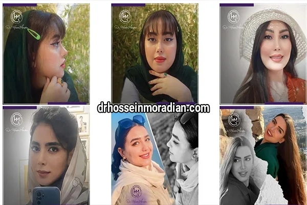 راز محبوبیت دکتر مرادیان به عنوان بهترین جراح بینی شیراز