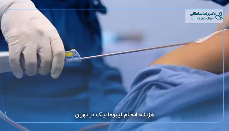 هزینه لیپوماتیک