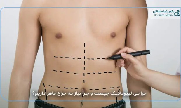 چالش‌های جراحی لیپوماتیک در ناحیه مچ و ساق پا؛ دقت در انتخاب جراح