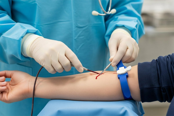 فصد خون چیست